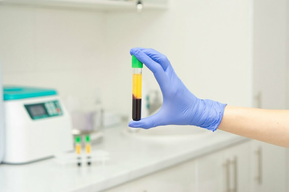 Close,Up,Medic,Woman,Hand,In,Blue,Medical,Gloves,Holds